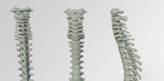 Kiedy wypadanie włosów jest niepokojące?